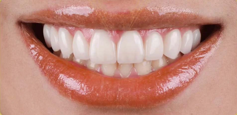 طراحی لبخند دکتر نجمه خادمه الرسول