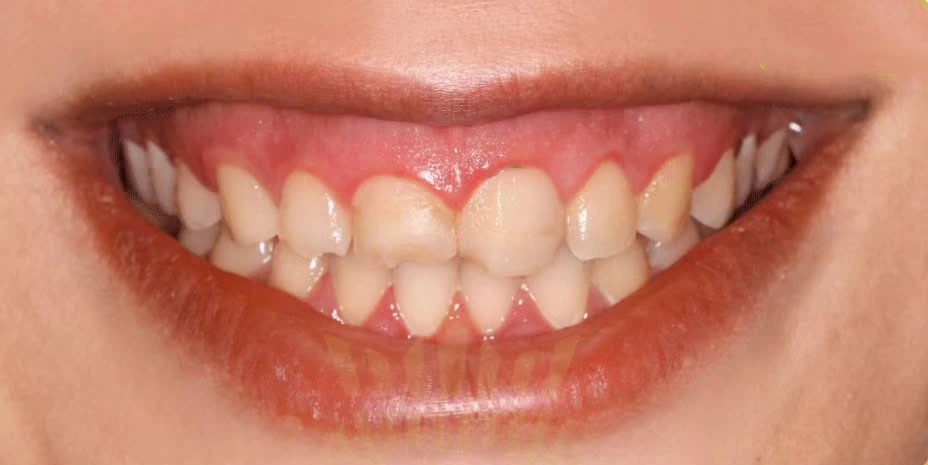 طراحی لبخند یونیک