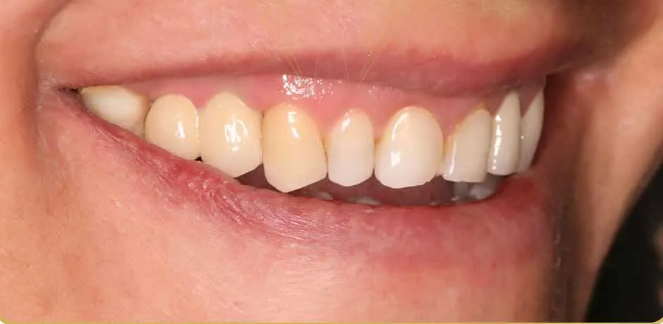 Root Canal Therapy unique dental