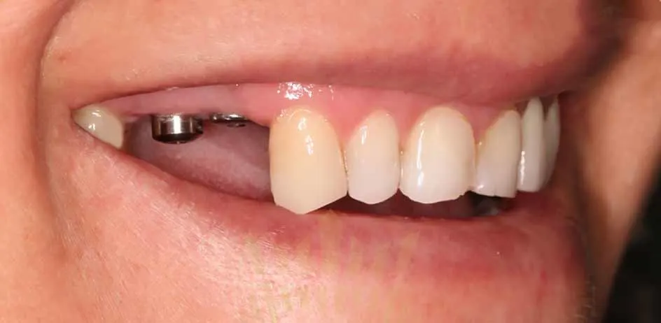 Preventive Care Unique Dental Clinic