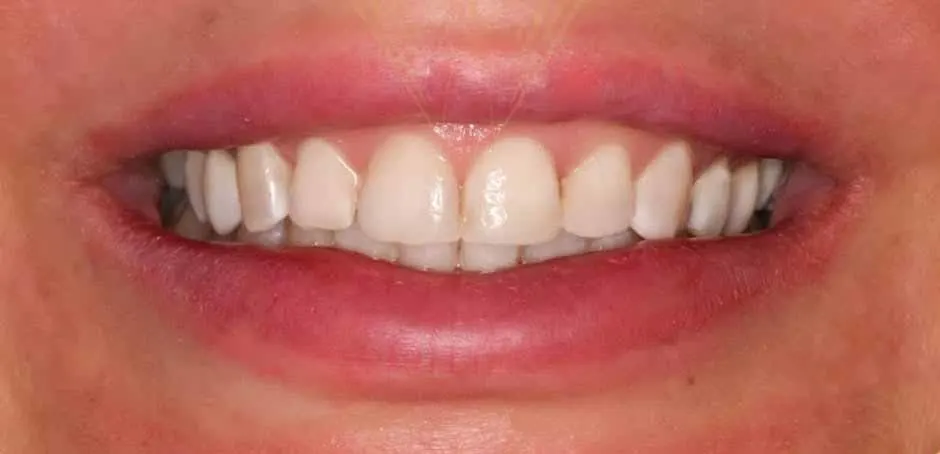 Bleaching unique dental clinic