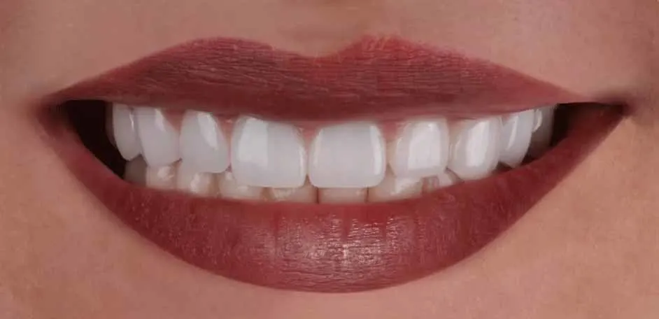 dr. mahdi khadematolrasoul Dental Implants