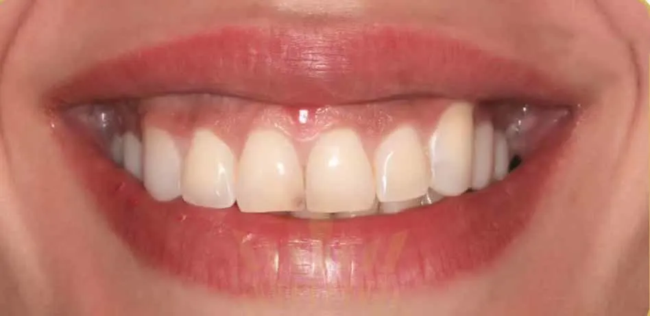 najme khadematolrasoul