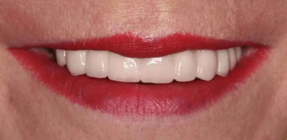 Prosthodontic Treatments Unique Dental