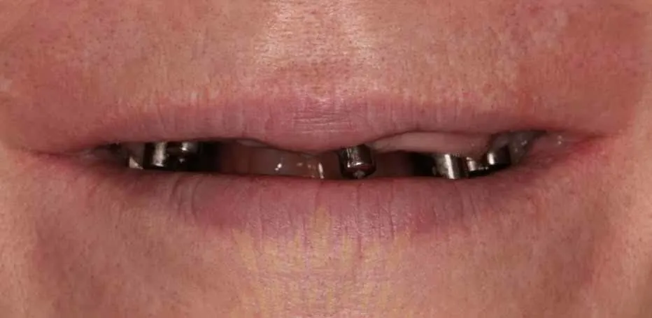 shiraz unique dental