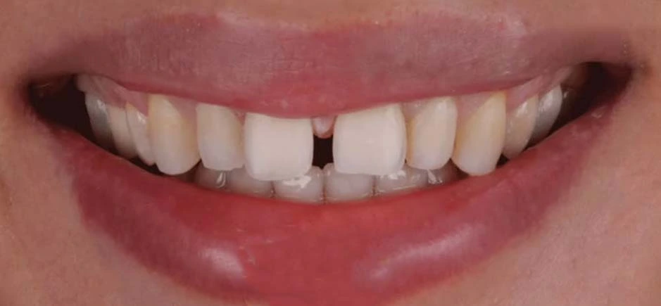 smile design unique clinic