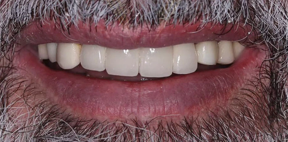 composite unique dental clinic