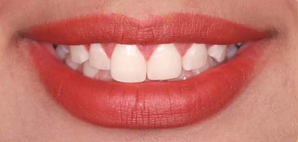 Esthetic Dentistry/Smile Design