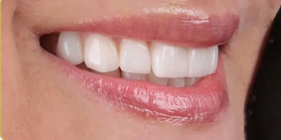 dr. najme khadematolrasoul Esthetic Dentistry