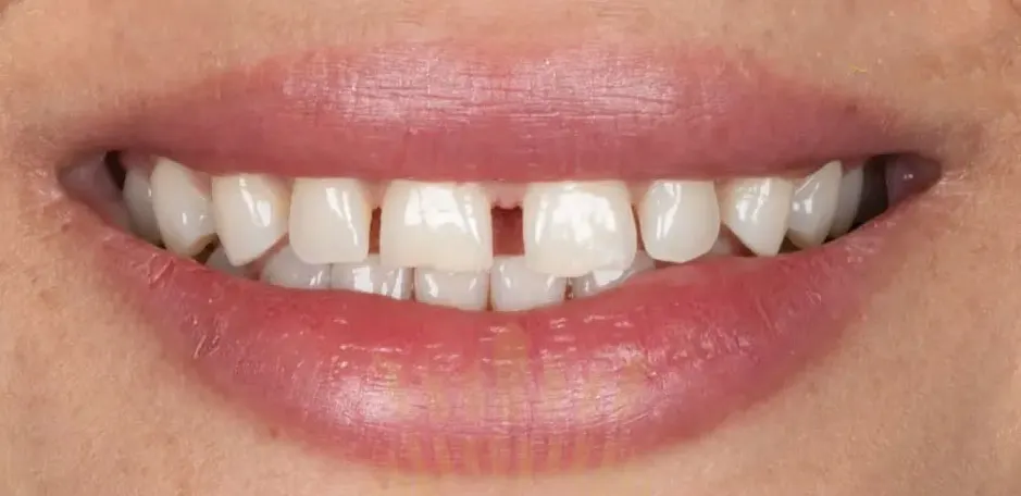 dr. maryam hejazi unique dental